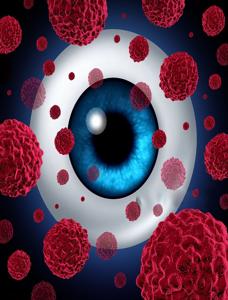 Cataract Surgery in Faridabad